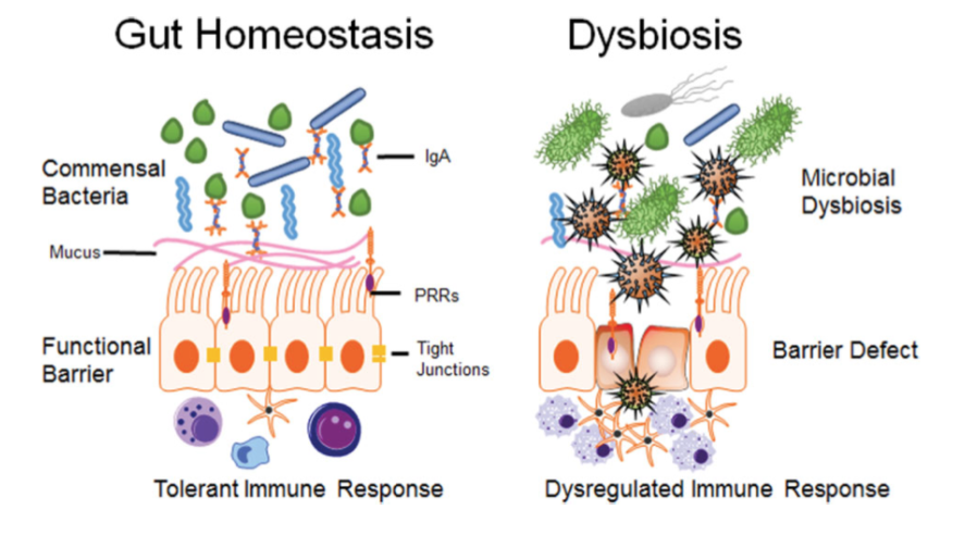 Image describing Gut homeostasis and Gut Dysbiosis 